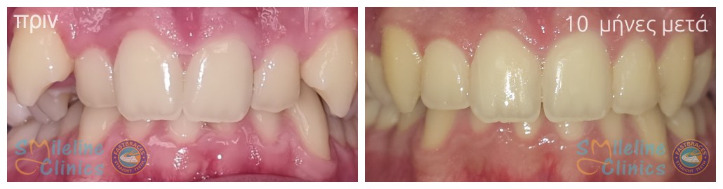 Περιστατικό 84