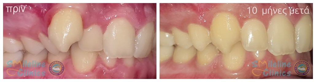 Περιστατικό 84