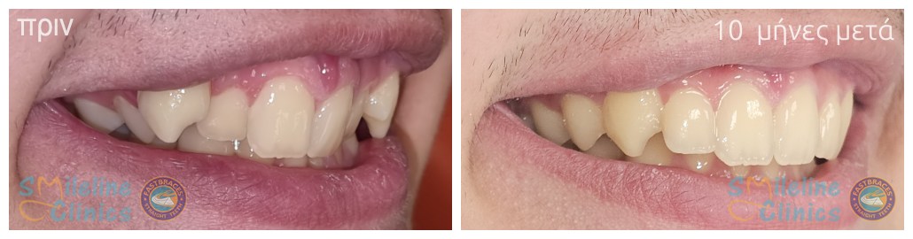 Περιστατικό 84