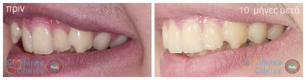 Περιστατικό 84