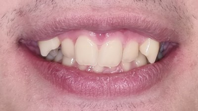 Περιστατικό 84