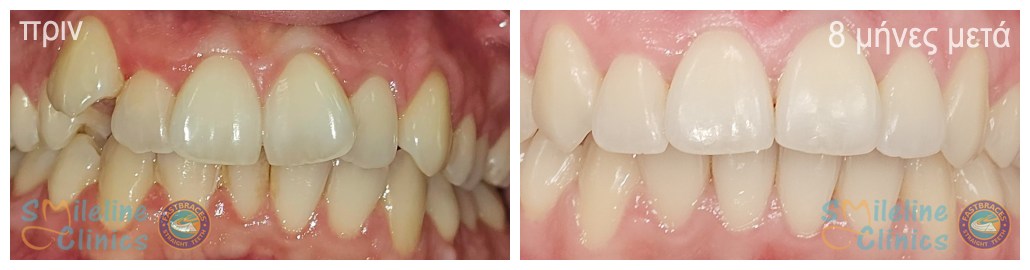 Περιστατικό 85