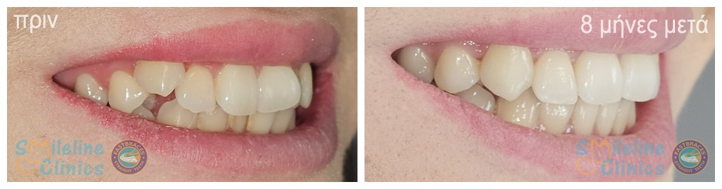 Περιστατικό 85