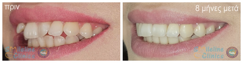 Περιστατικό 85