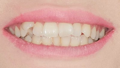 Περιστατικό 85