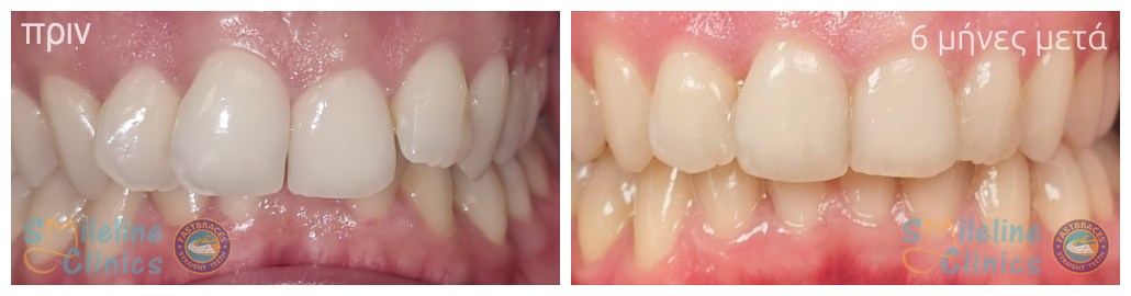 Περιστατικό 86