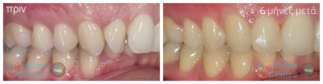 Περιστατικό 86