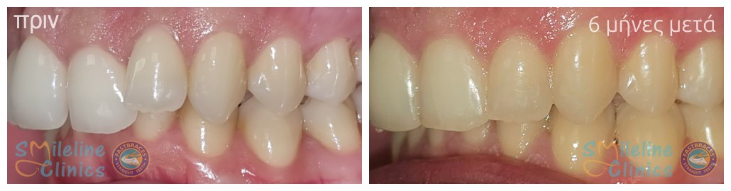 Περιστατικό 86