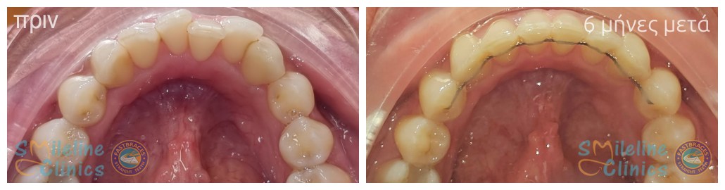 Περιστατικό 86