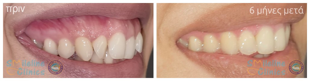 Περιστατικό 86