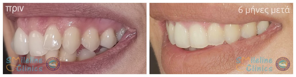 Περιστατικό 86