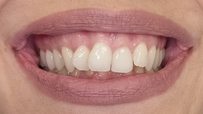 Περιστατικό 86