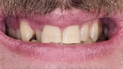 Περιστατικό 87